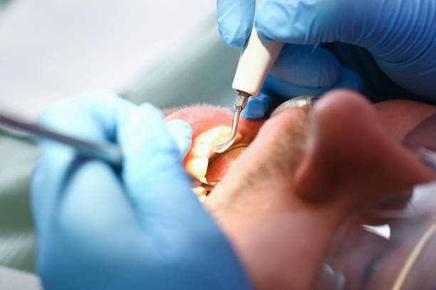 Best Emergency Dental Care for Abscessed Tooth in Allen Park, MI