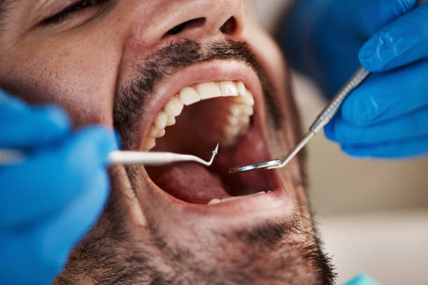 Best Emergency Dental Services for Seniors in Allen Park, MI