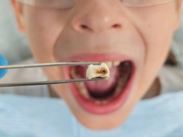 Best Orthodontic Emergency Dentist in Allen Park, MI